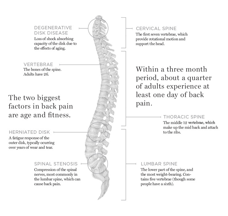 1504-trueorfalse_spine_diagram.jpg